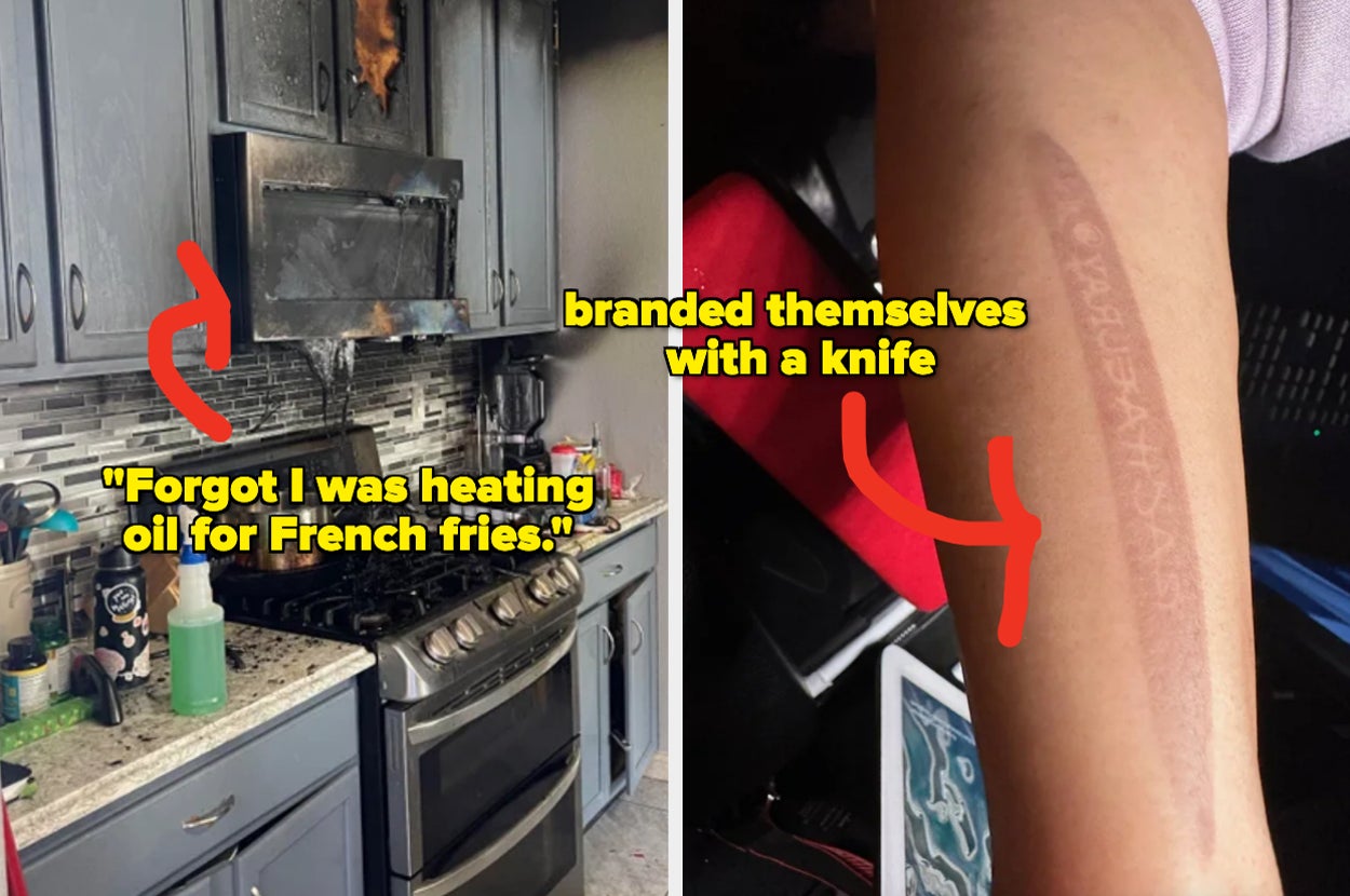 a destroyed kitchen after someone forgot they were heating french fry oil, and someone who accidentally branded themselves with a knife