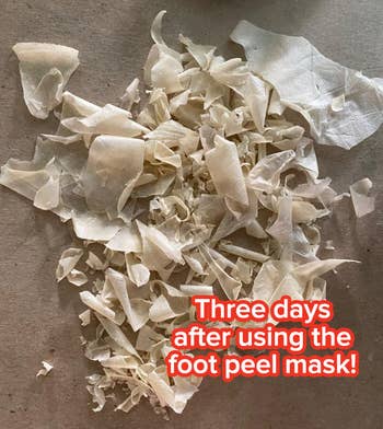 pile of the same reviewer's dry foot skin three days after using the foot peel mask