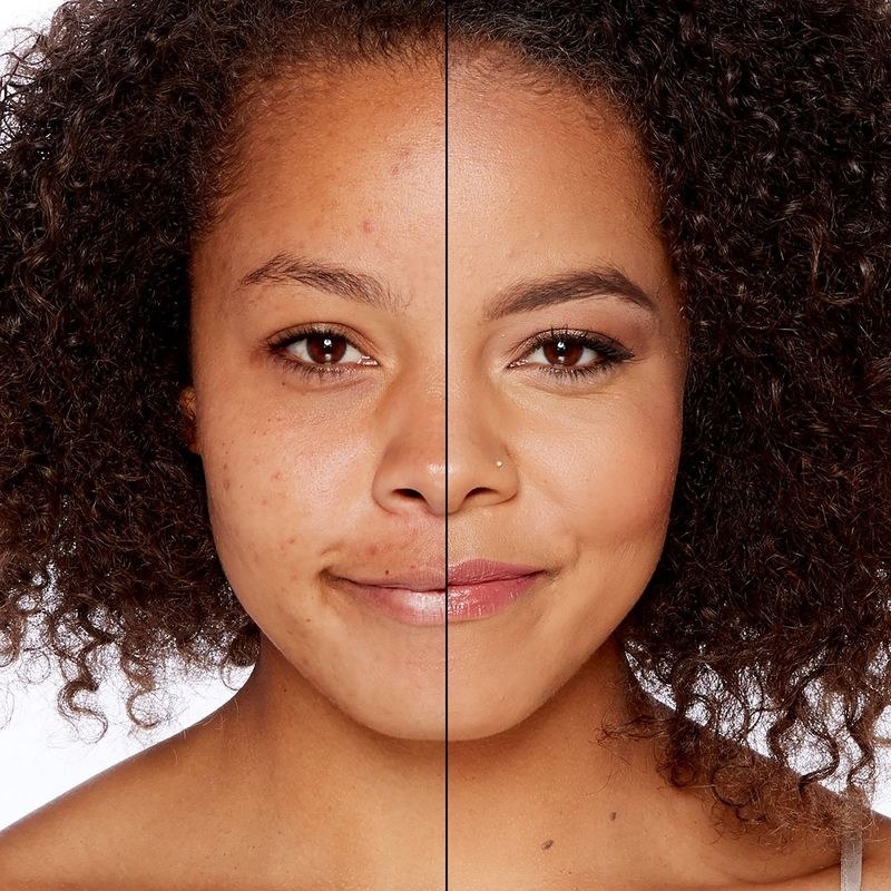 A person showing before and after images of their skin with using foundation