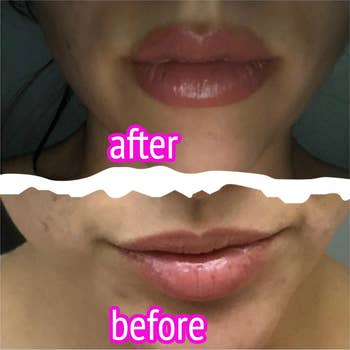 reviewer's lips before and after using lip plumper