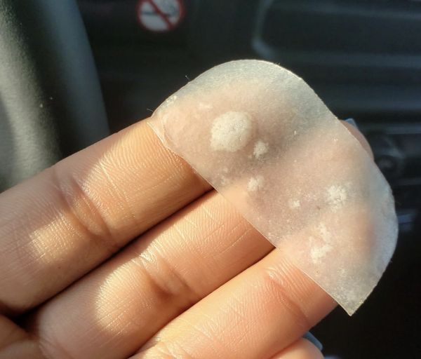 closeup of puss from blemishes stuck onto face strip removed and displayed on reviewer&#x27;s hand