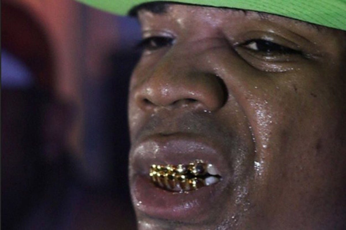 Plies Gold Teeth