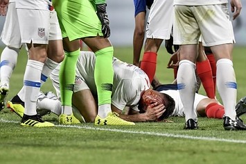 USA's defender Matt Miazga (C) is injured during the match between France and USA