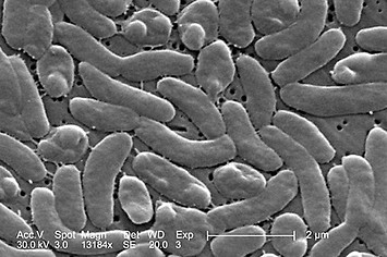 This is a photo of bacteria
