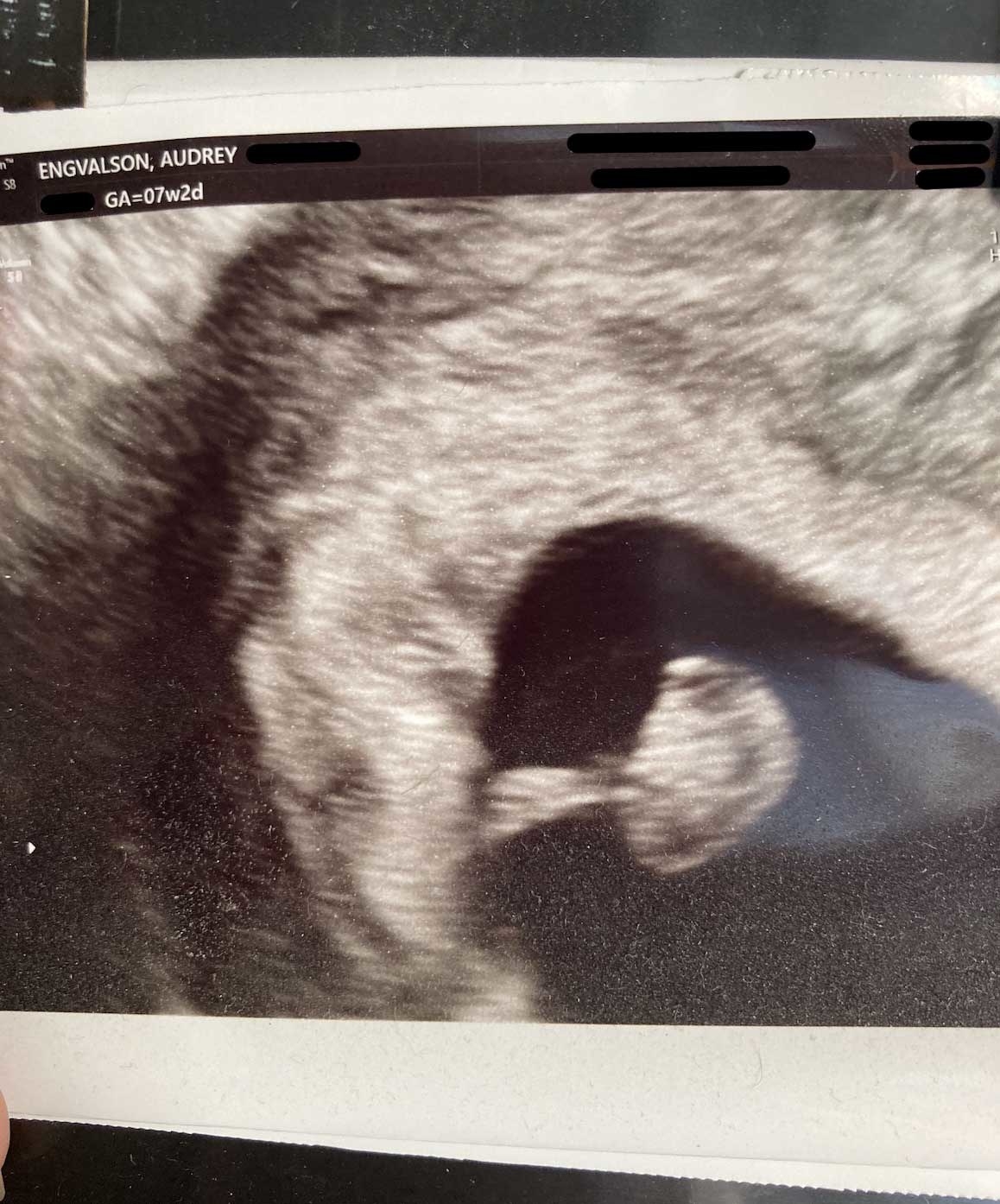 an ultrasound photo