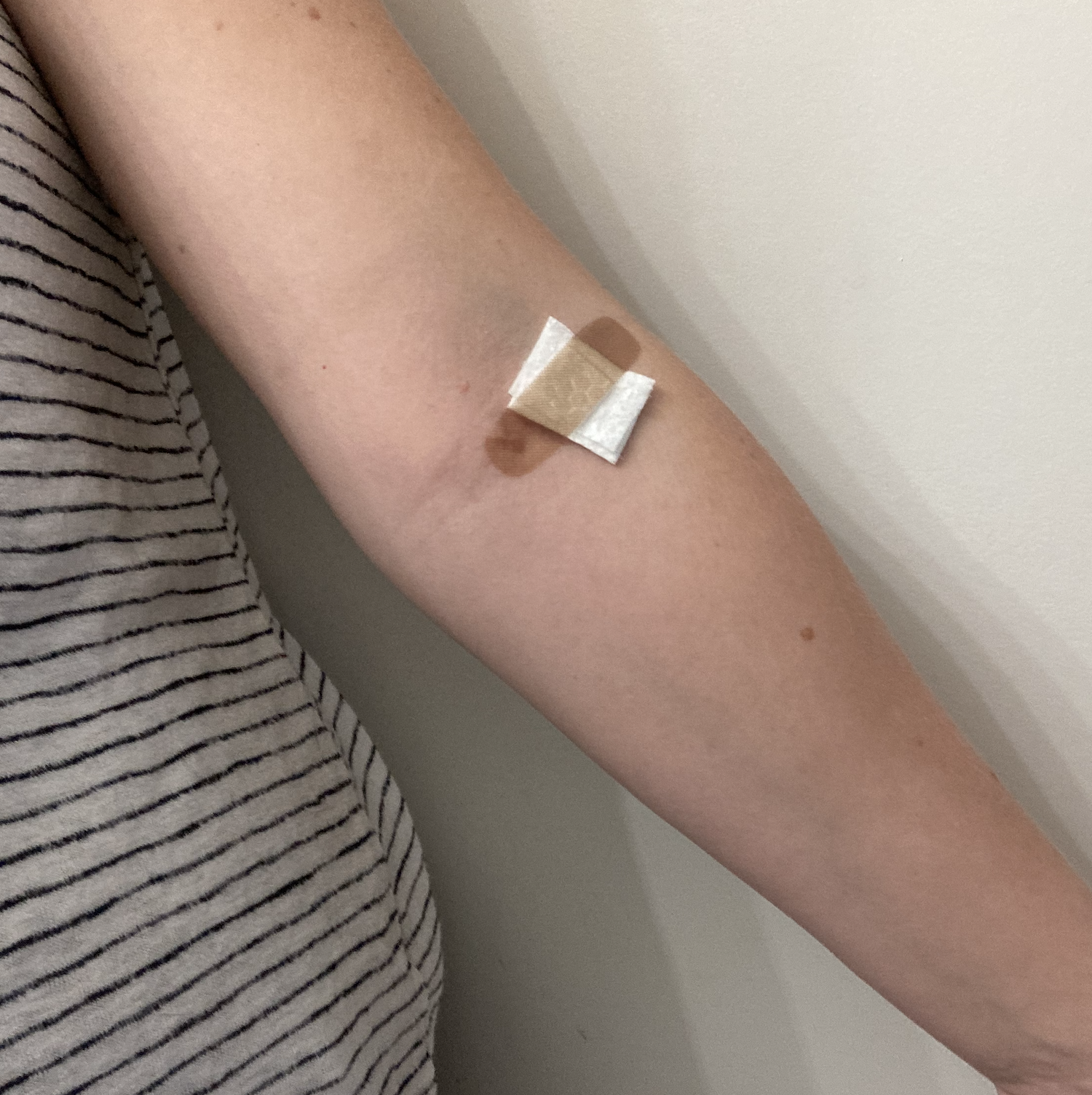 the author&#x27;s arm with a Band-Aid on it