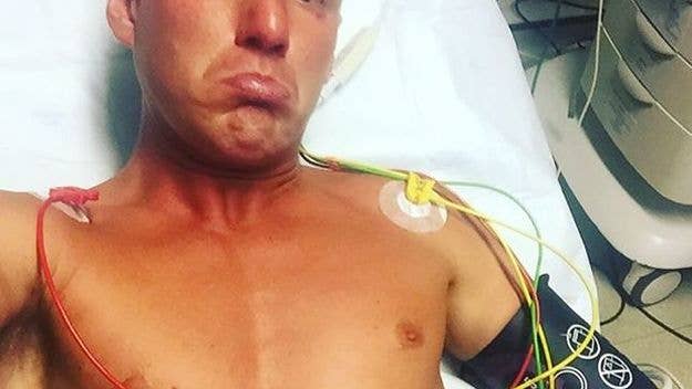 Brad Thorn slams UK reality star during charity match, breaks two ribs.