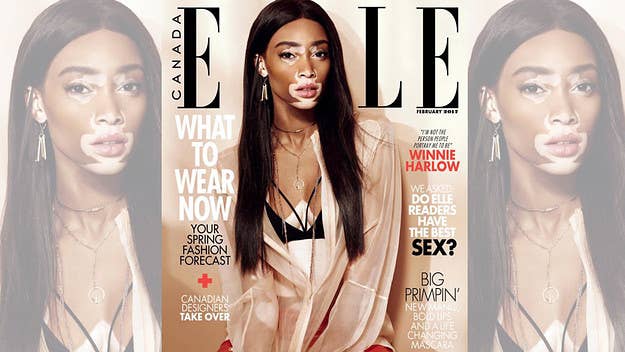 The 22-year-old Canadian model lands her first cover with Elle Canada