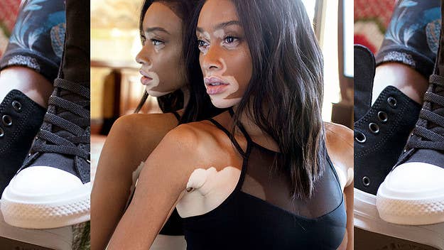Winnie Harlow Speaks on Taking Chucks from the Streets to the Runway