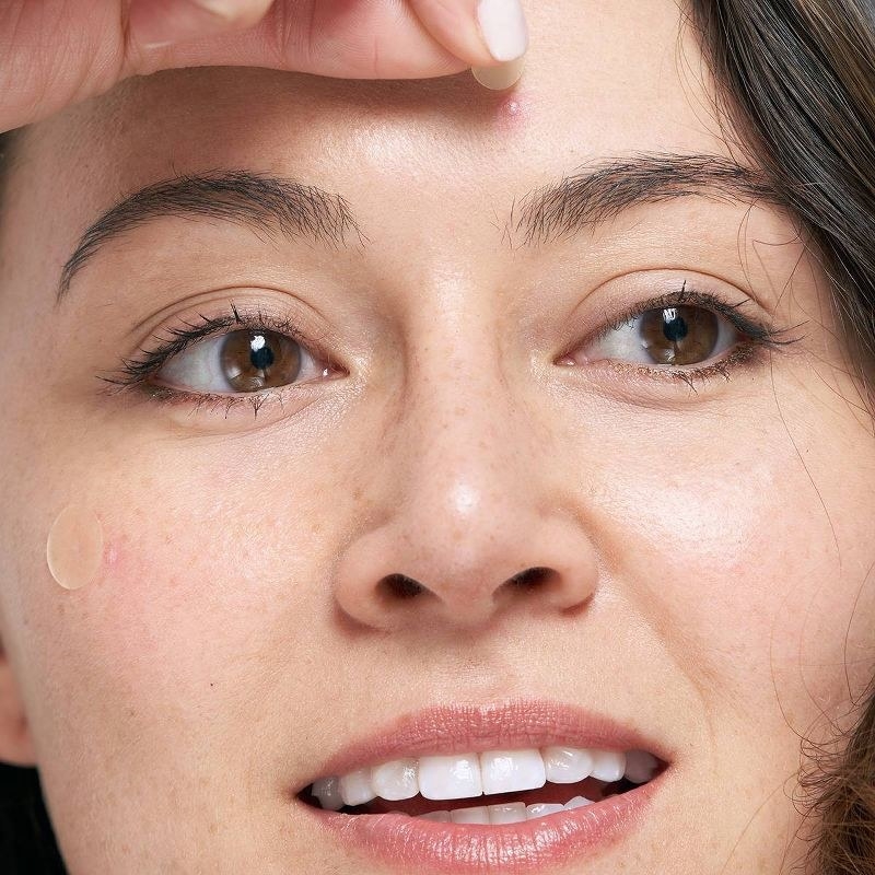 A person applying pimple patches to their skin