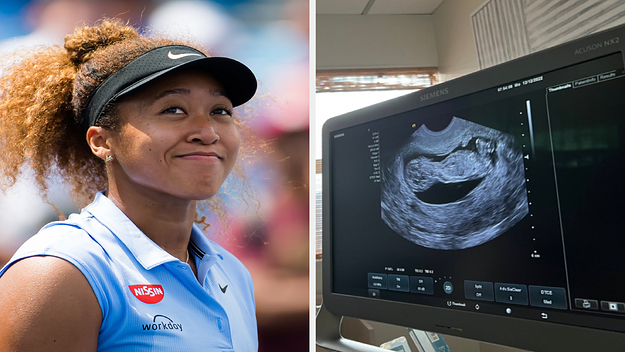 Pregnant Naomi Osaka Announce Gender Of Their 1st Child, She's