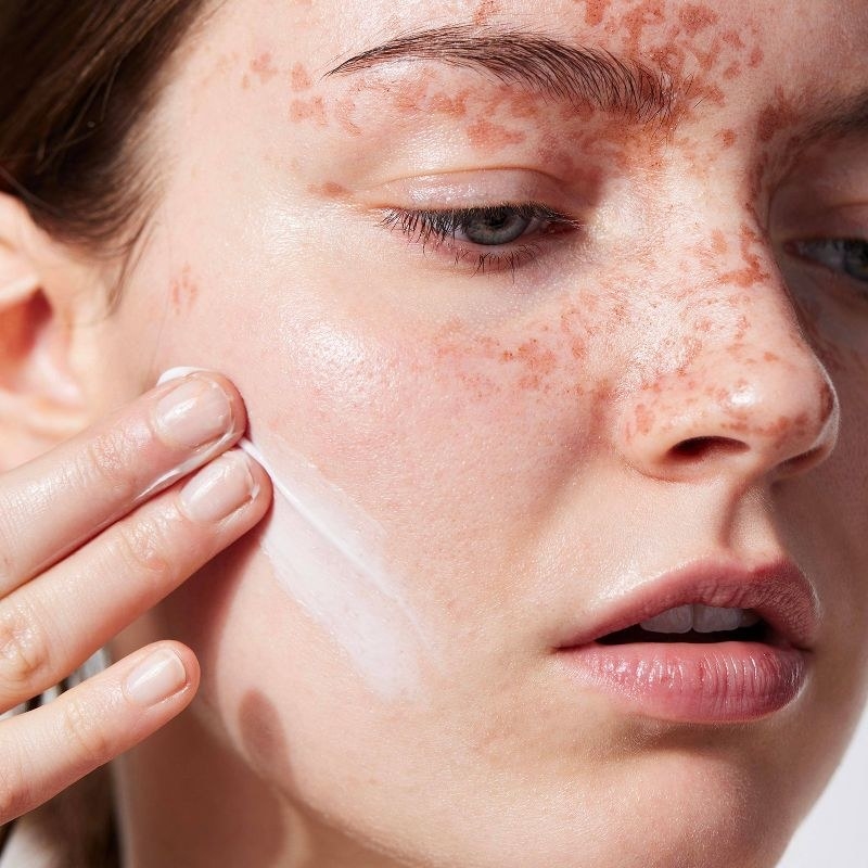A person applying moisturizer to their skin