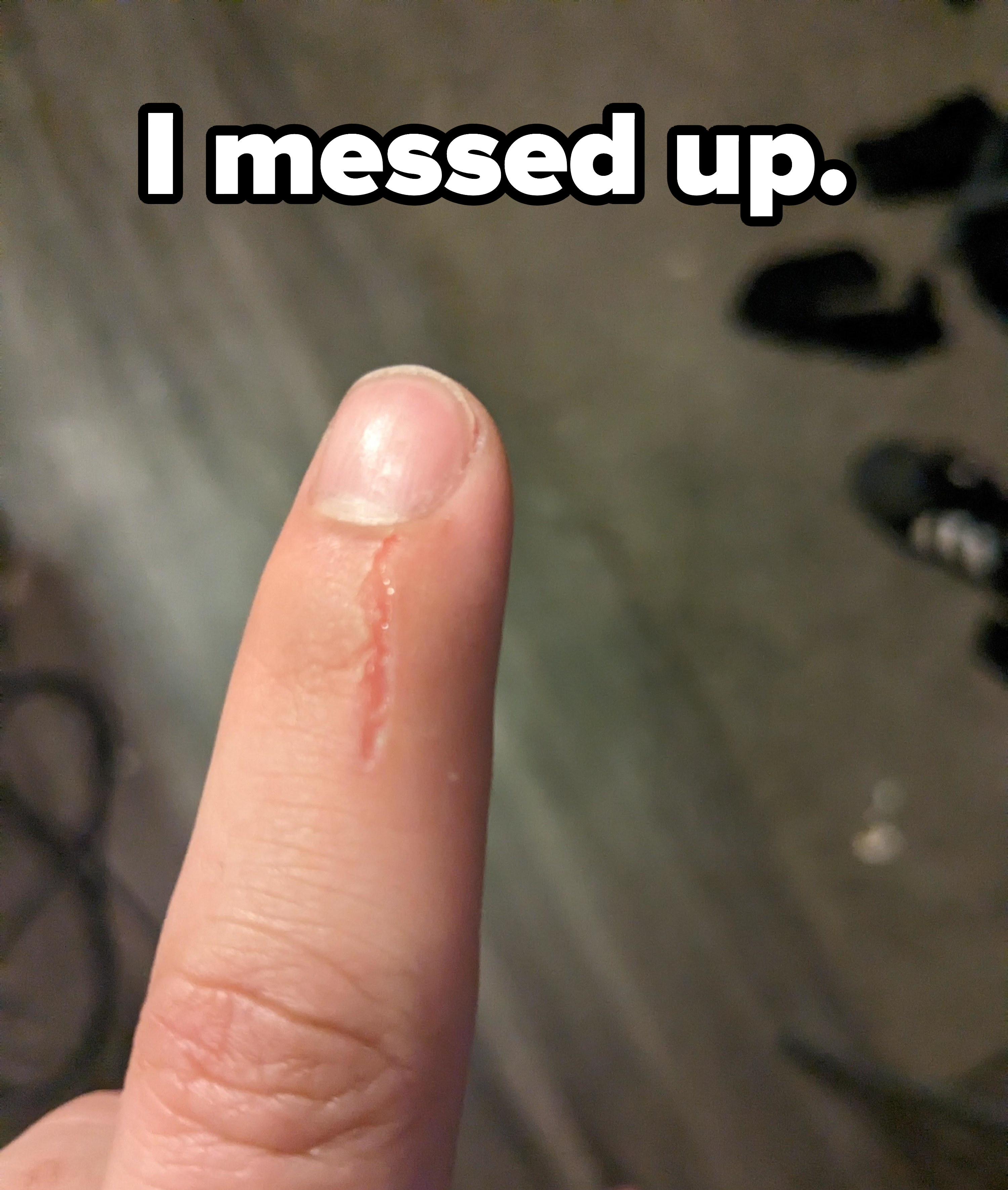 A strip of missing skin extending from a fingernail