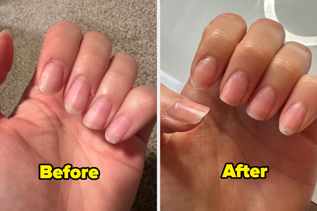 7 nail symptoms and conditions you shouldn't ignore - TODAY