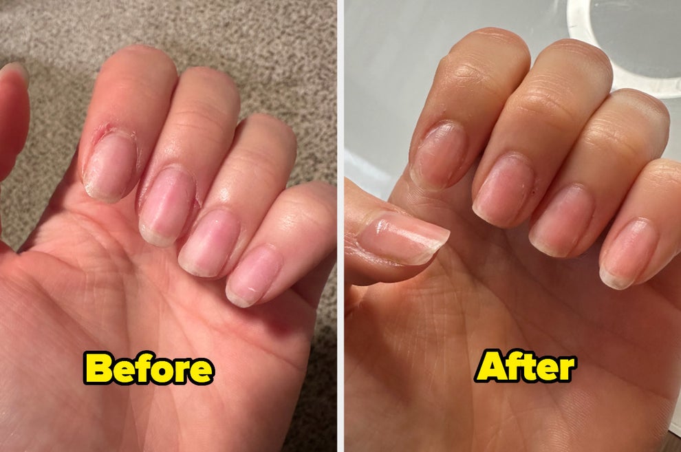How Long Can You Handle Growing Out a Manicure Before You Just