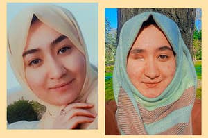 Fatima Amiri, an afgan girl in a hijab. The picture on the right is her before the accident, and the picture on the left is her after the accident when she lost her eye.