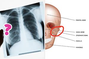 two images: on the left is an x-ray of a ribcage, on the right is a drawn image of a skull with arrows pointing to different bones