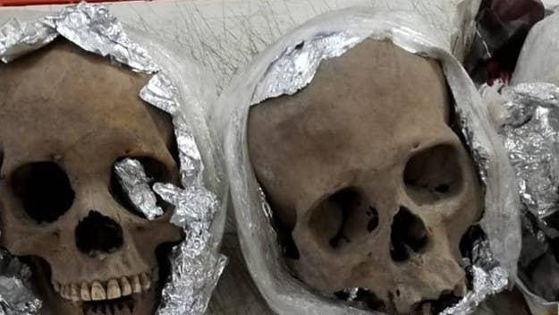 The skulls were discovered inside a cardboard box after an X-ray machine at a Mexico airport uncovered "abnormal organic material," spurring a search.