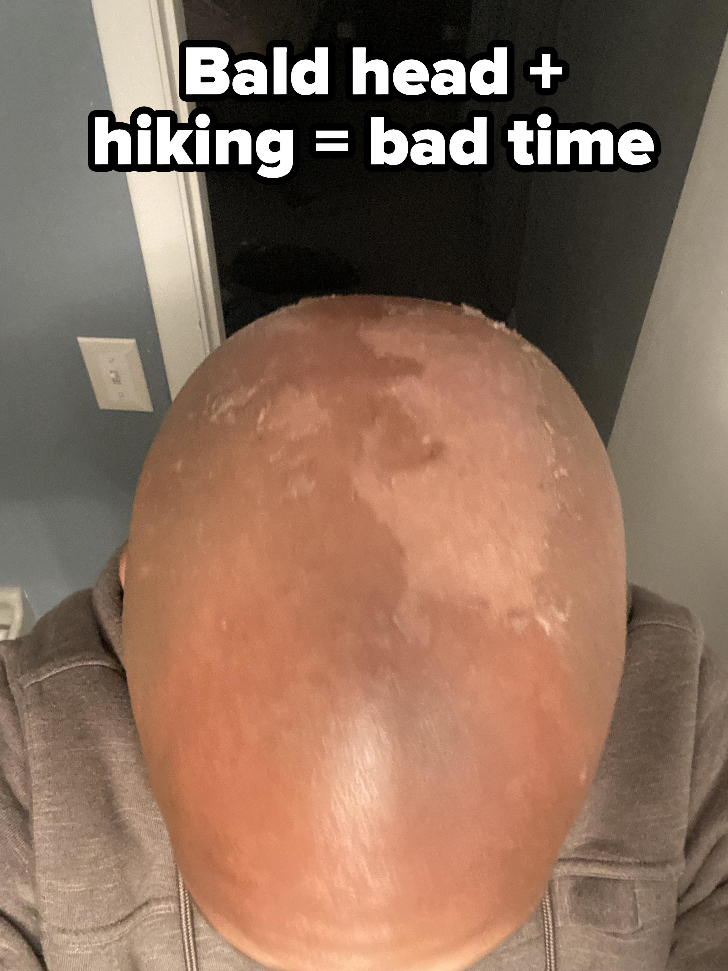 bald guy with sunburn on his head