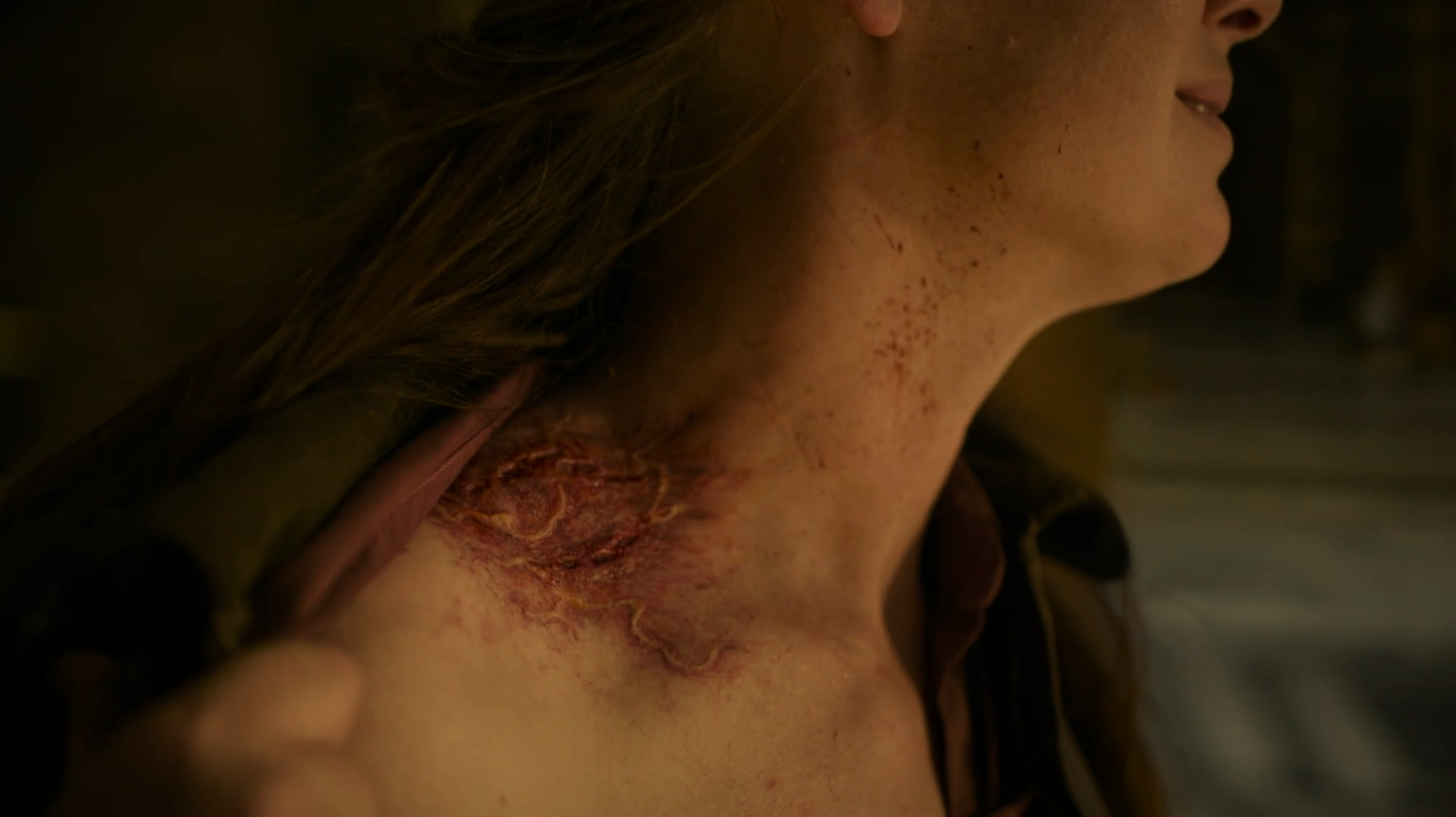 A close up of a bite from one of the infected on Tess&#x27; shoulder