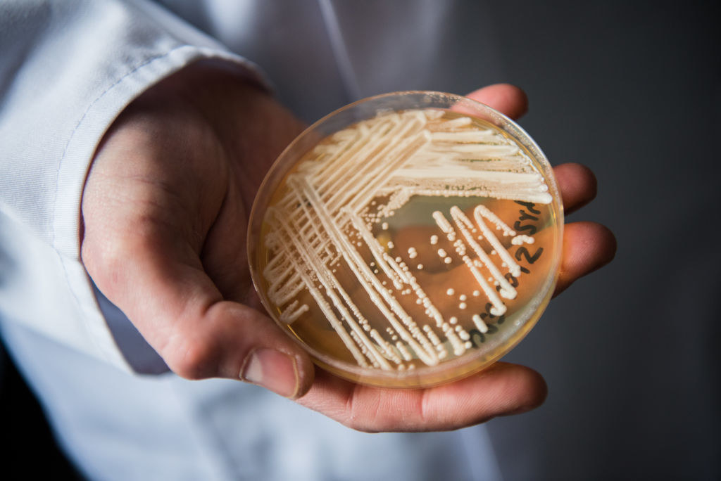 holding a petri dish holding the yeast candida auris