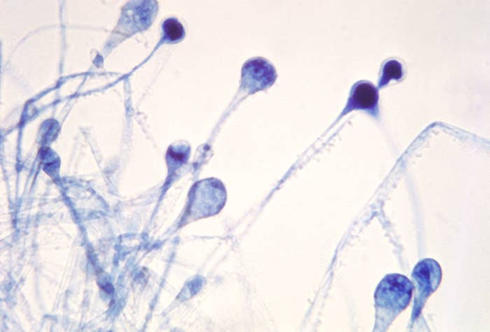 Photomicrograph Reveals A Number Of Young Sporangia Of A Mucor Spp. Fungus.
