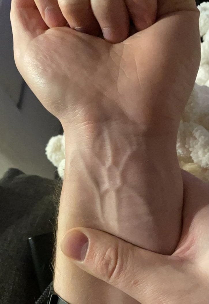 a person&#x27;s veins shaped like a hexagon