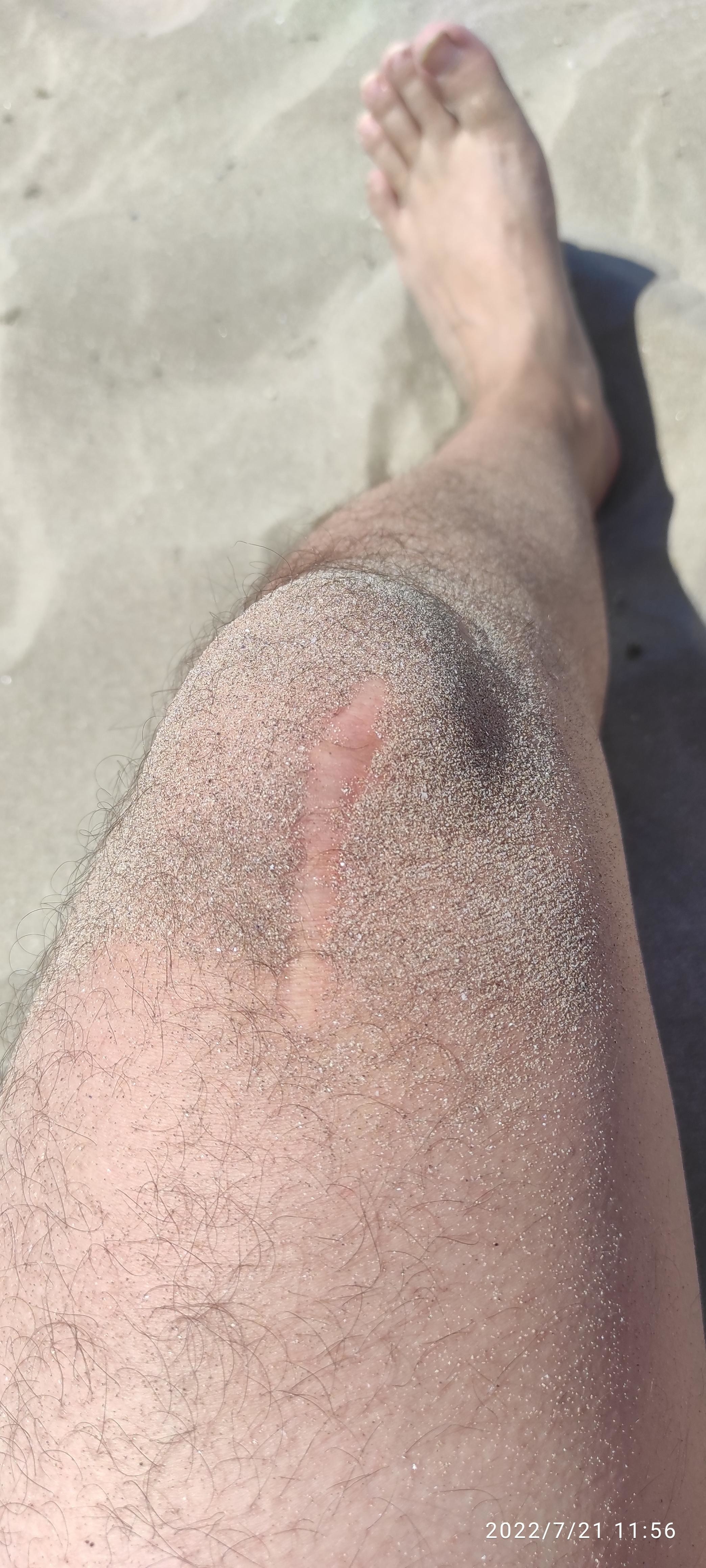A person&#x27;s leg covered in sand
