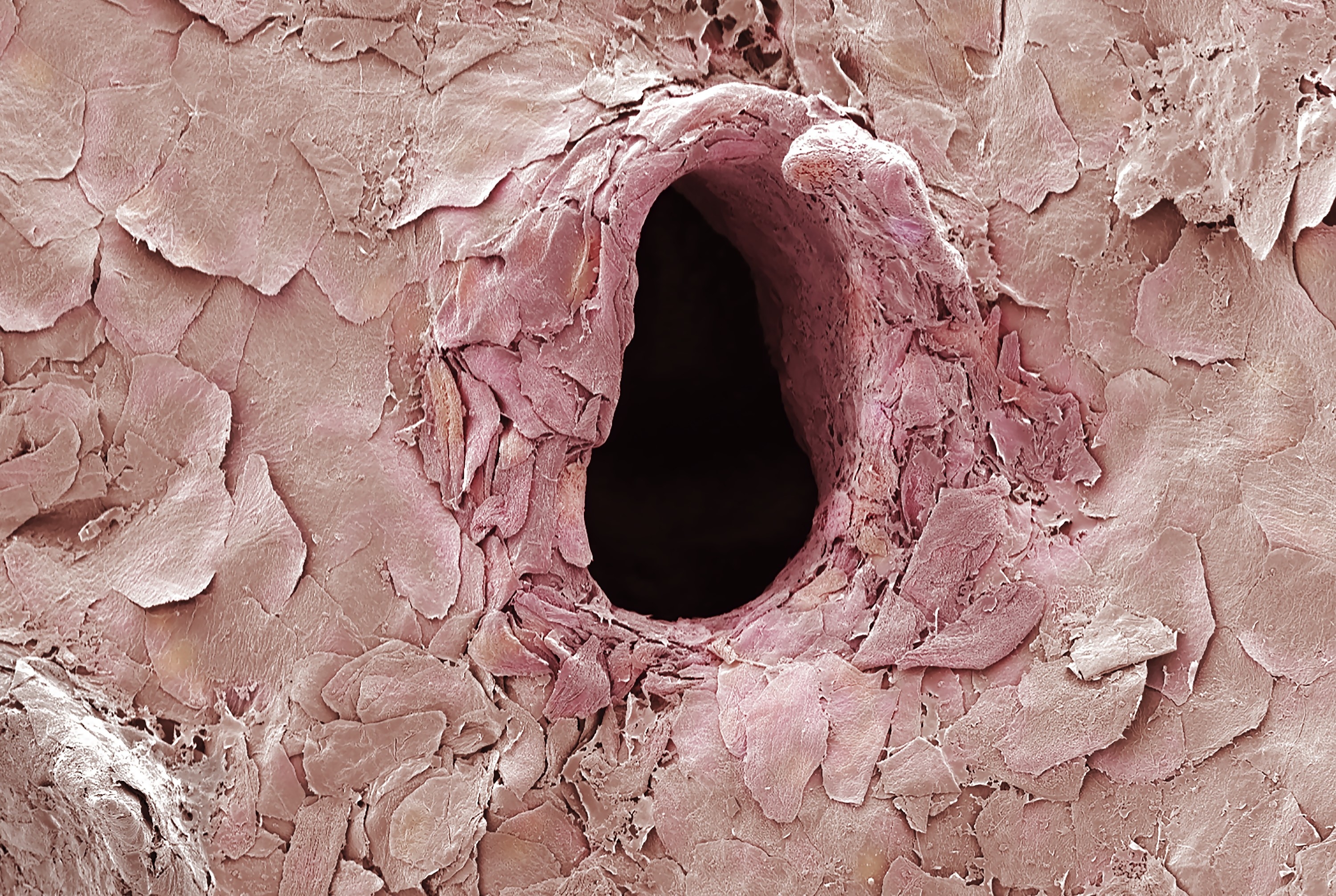 Pinkish, flaky surface with a large, raised hole in the middle