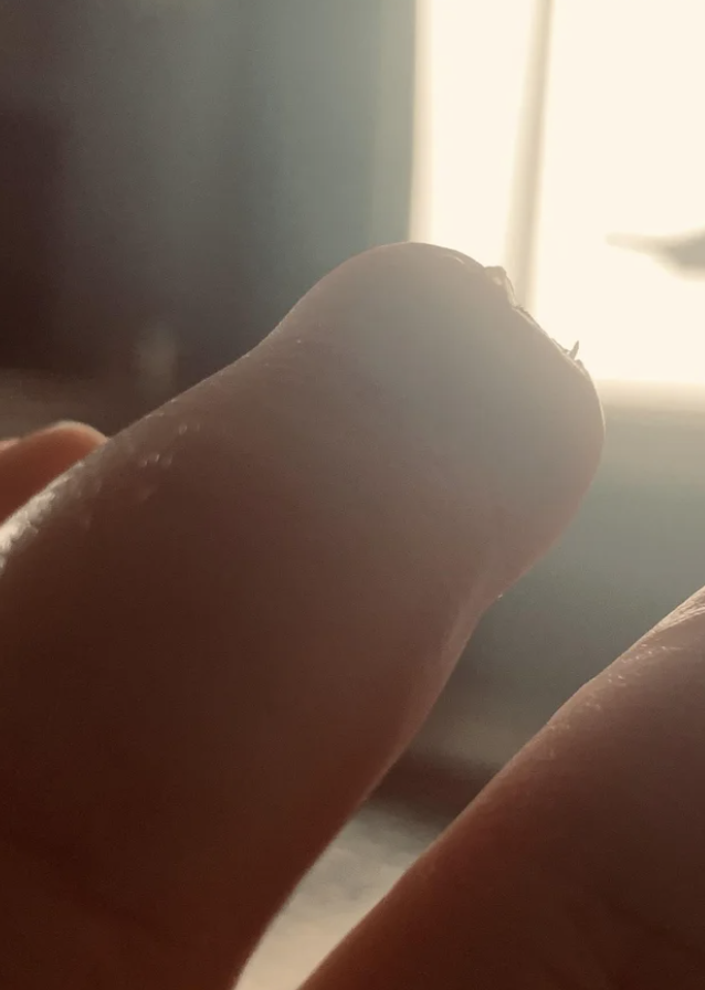 Close-up of a fingertip with tiny shards on top