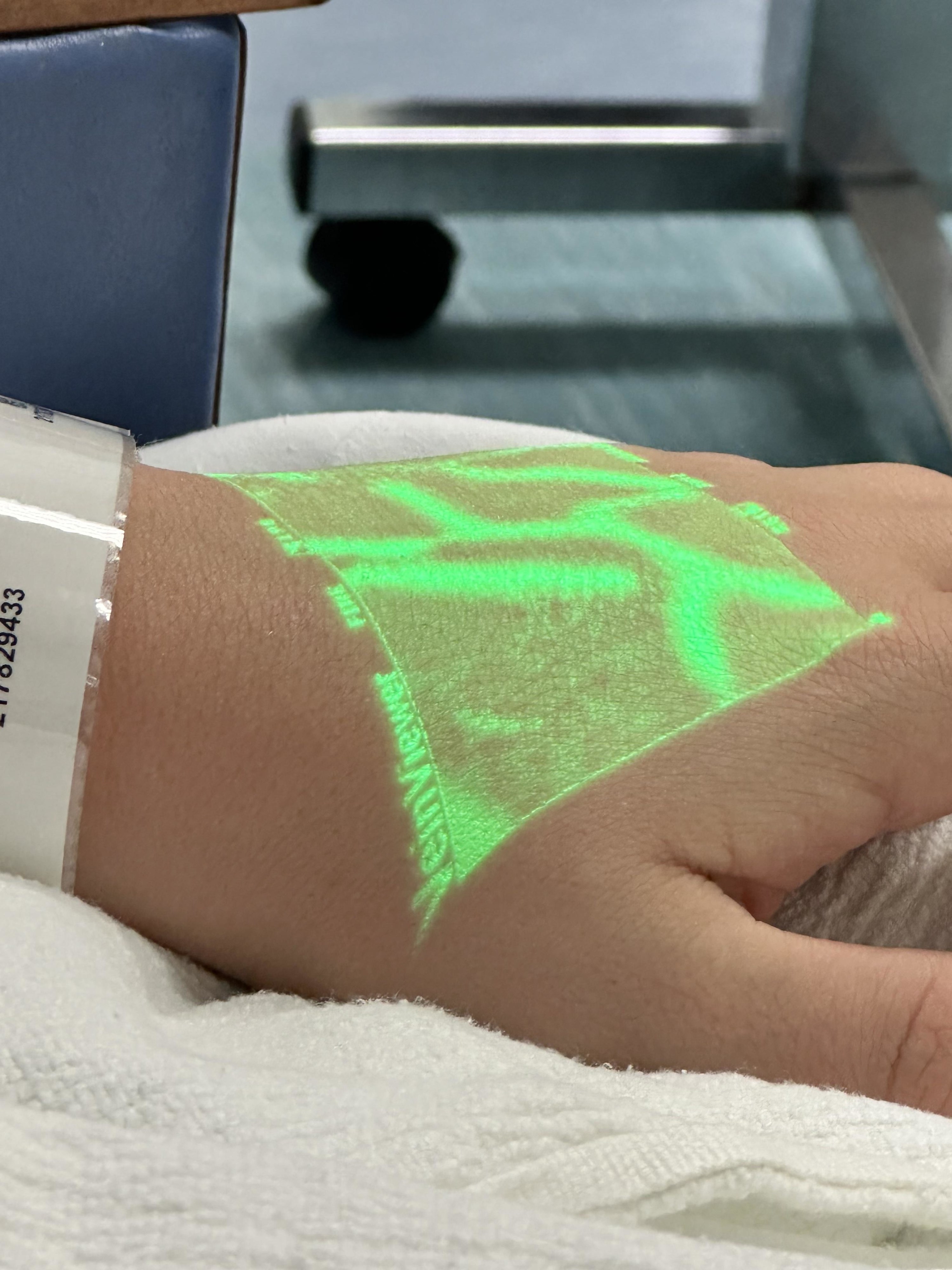 A person&#x27;s hand veins highlighted in neon green