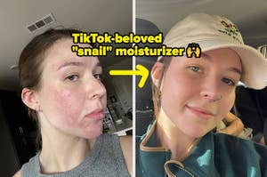 moisturizer before and after pics 