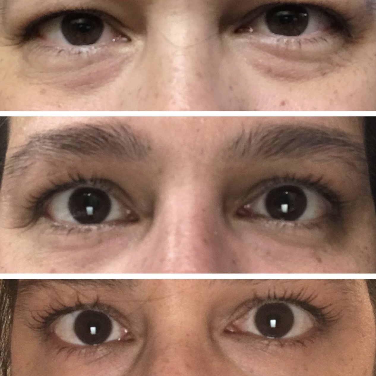 Different reviewer's progression showing their eye bags disappearing over time