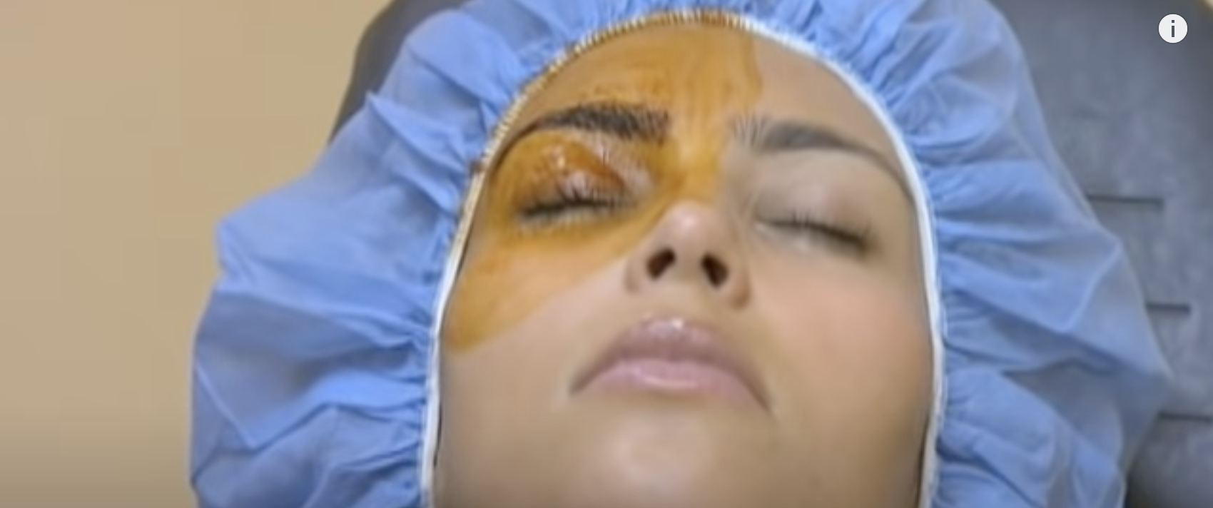 kim kardashian getting an eye procedure done