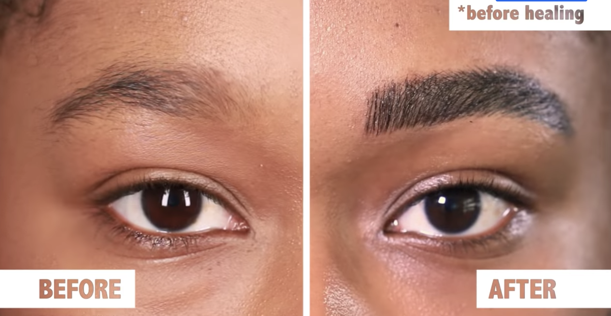 A woman&#x27;s microbladed brows