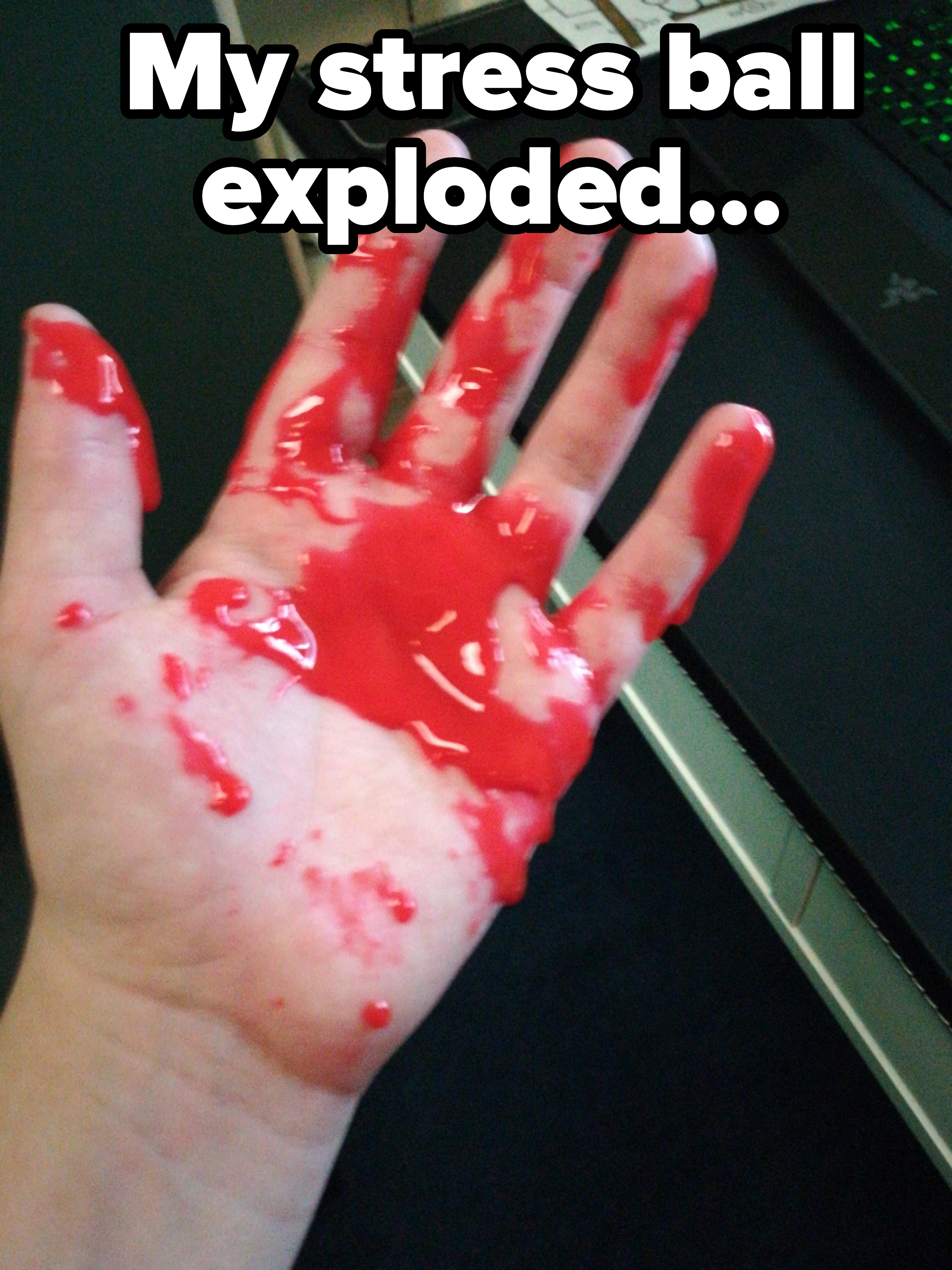 Person who had a stress ball explode in their hand