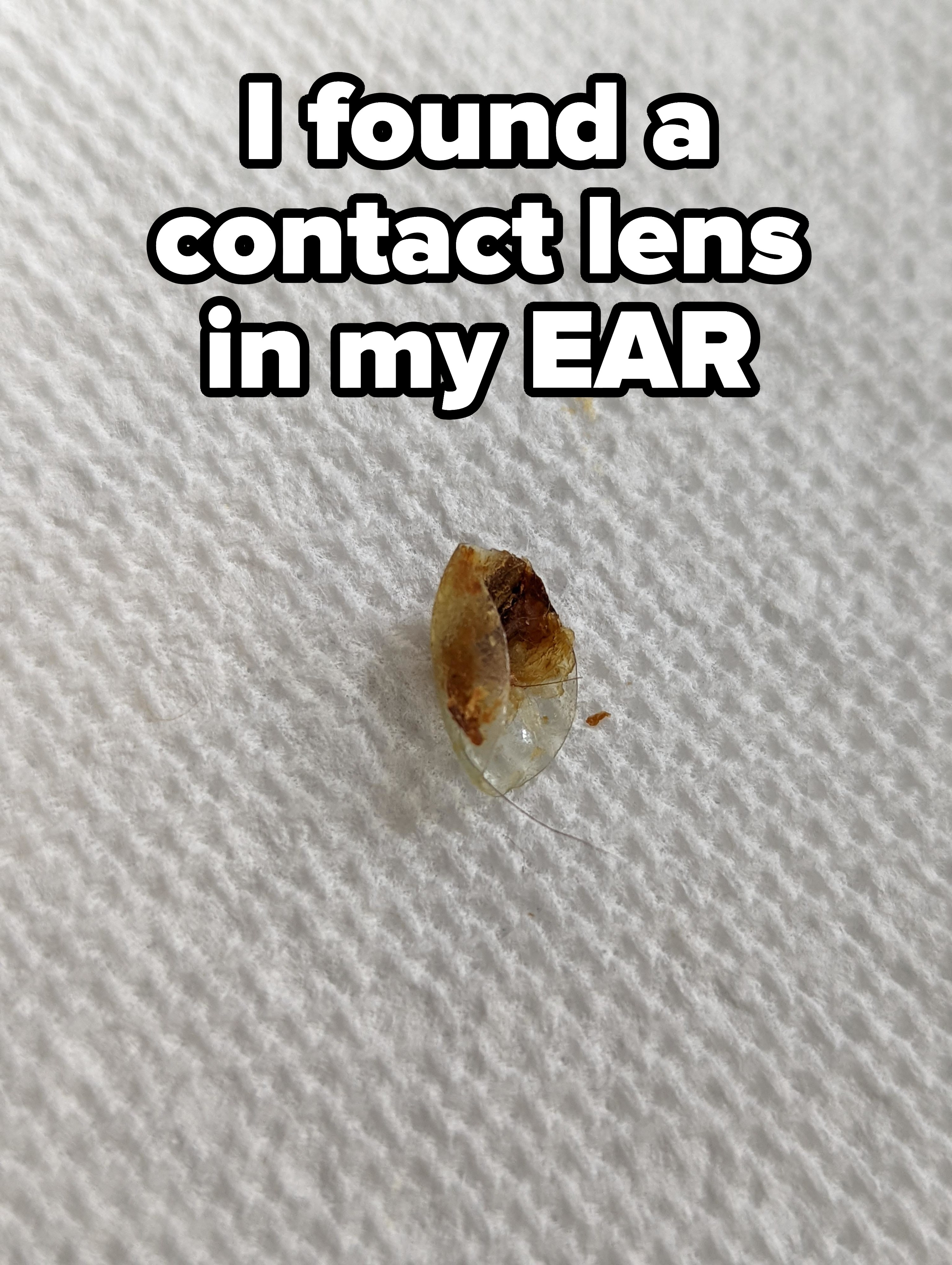 Folded contact lens with lots of ear wax that was found in an ear