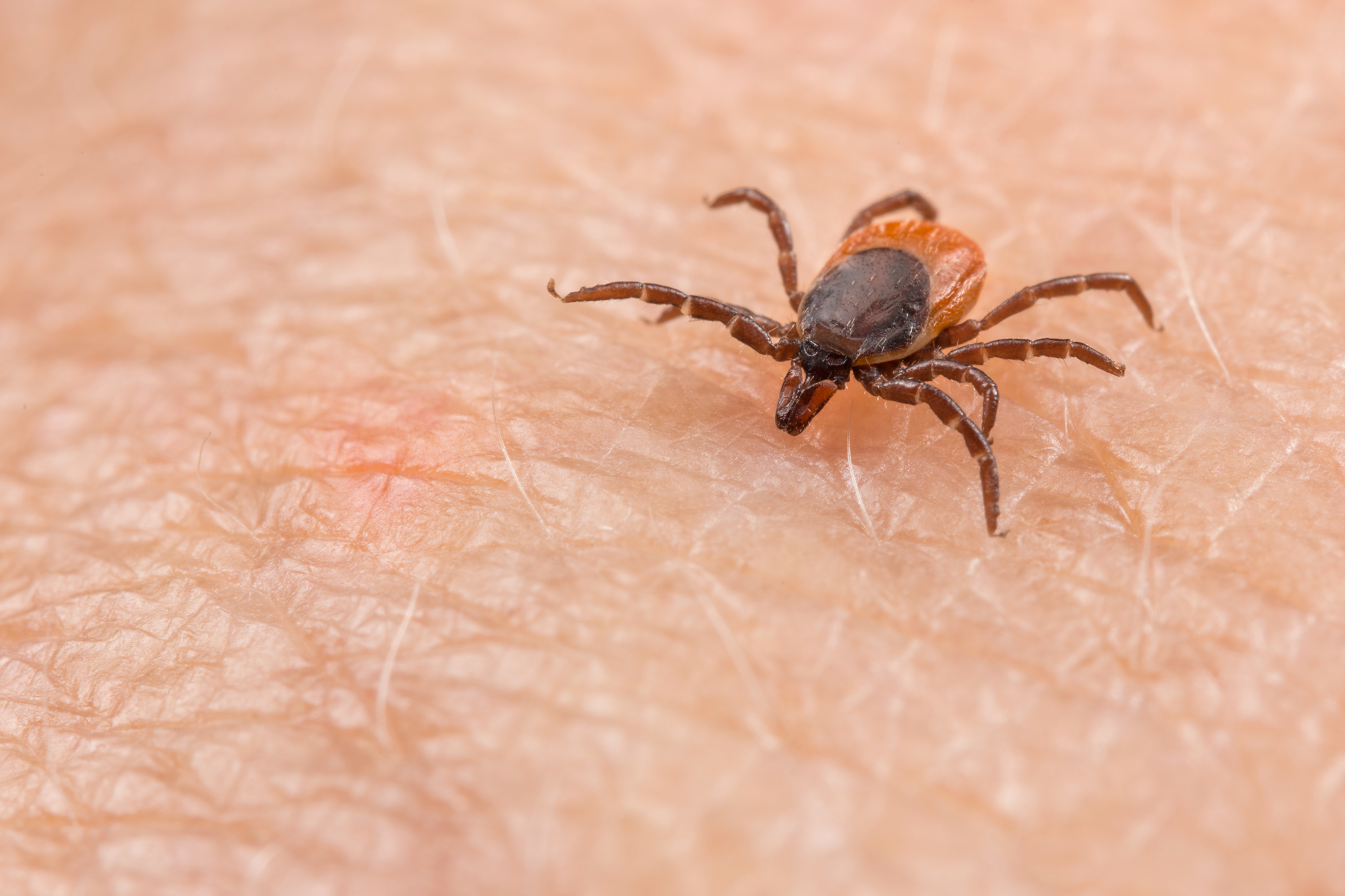 tick on a person&#x27;s skin