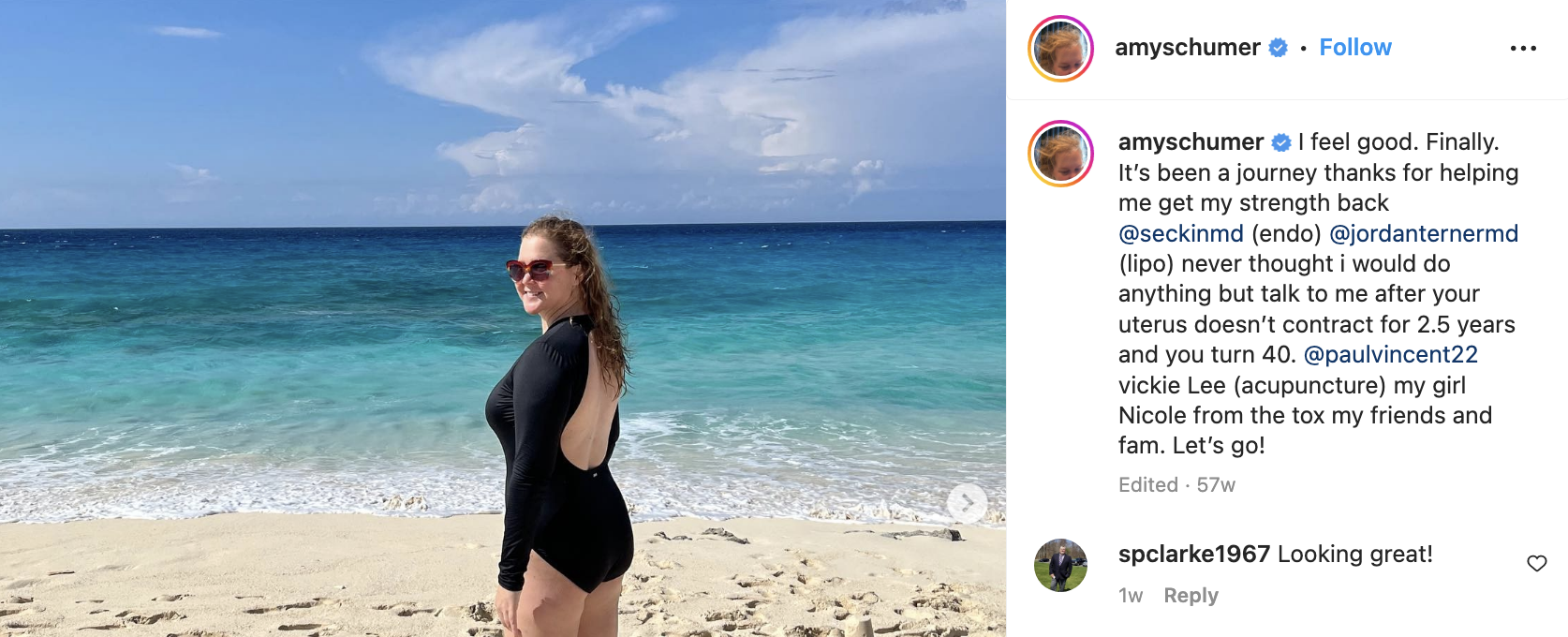 Amy smiling on the beach in an IG post, with a caption about how she feels good and it&#x27;s been a journey getting her strength back, and mentioning Dr Terner