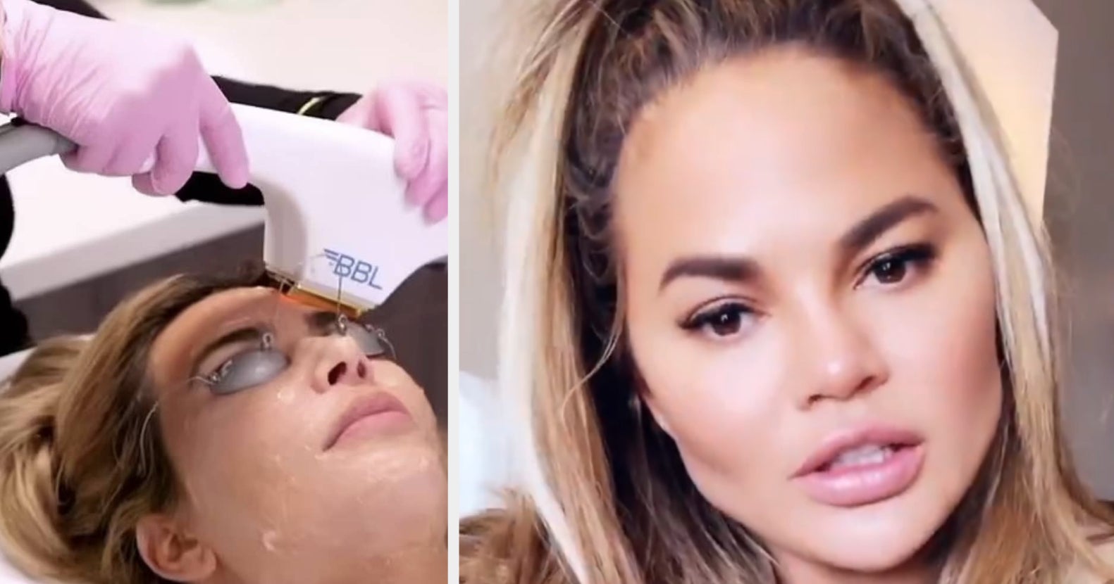 16 Times Celebrities Revealed What Cosmetic Procedure They Got Done And The Name Of The Doctor