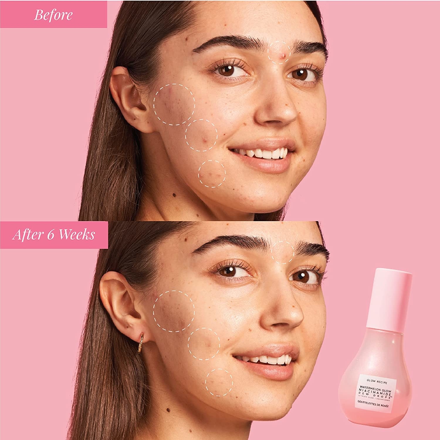 a person before and after using the serum