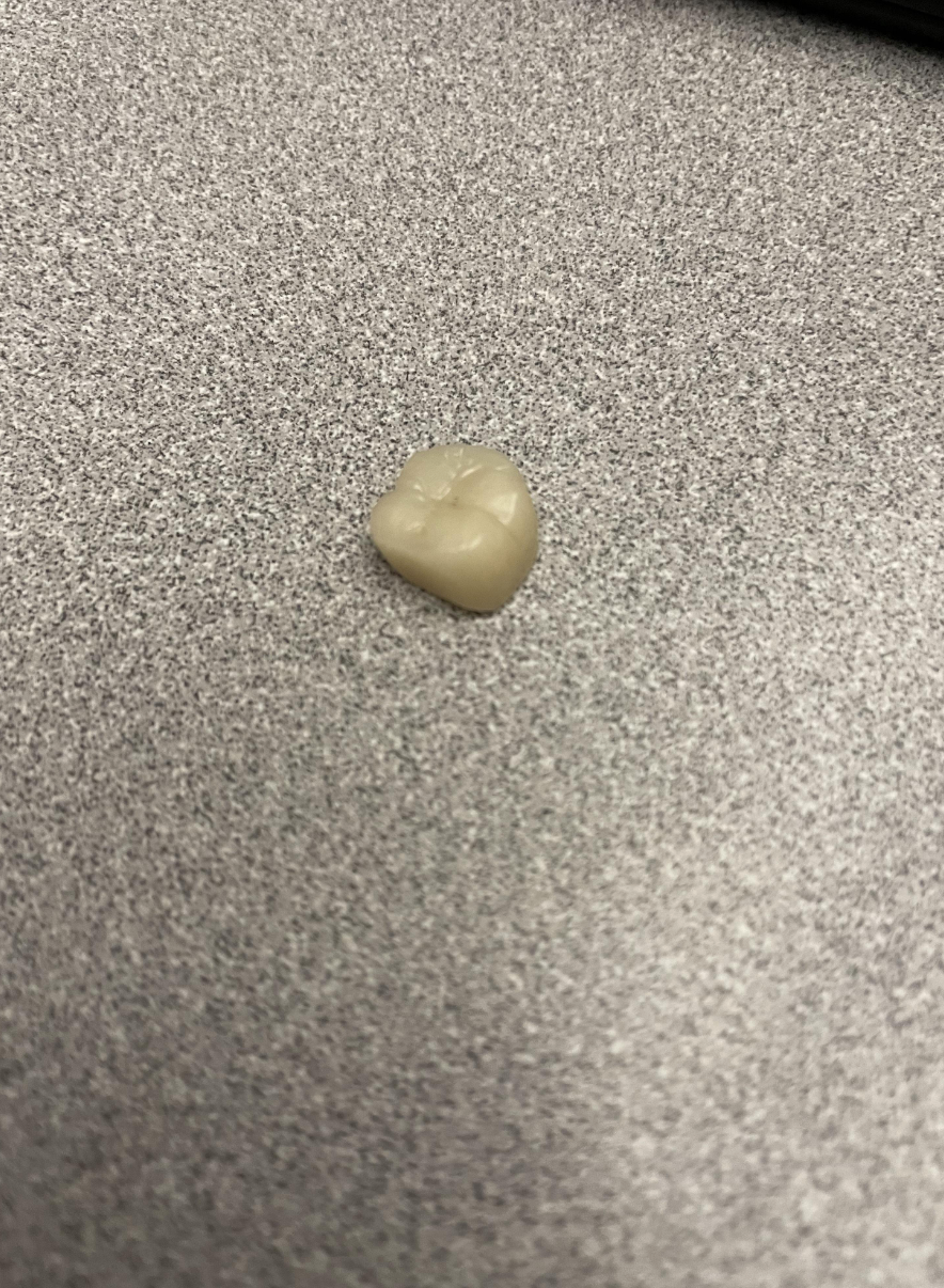 Loose tooth on desk