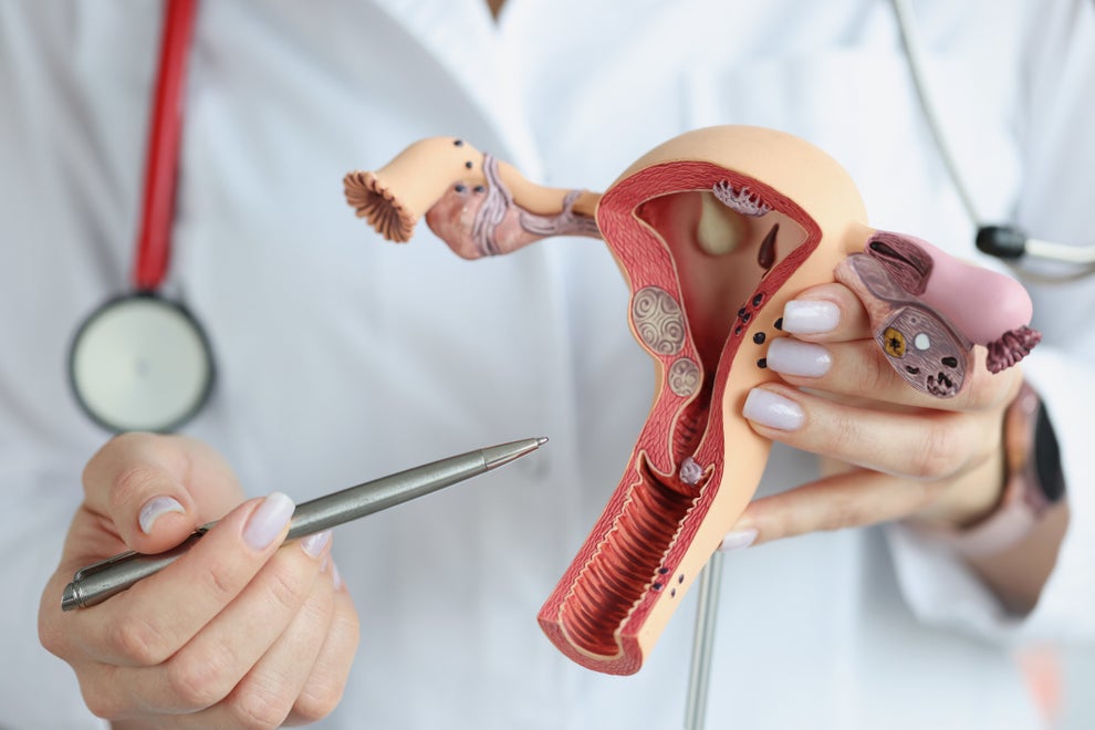 Iud Injuries TikTok Woman's IUD Causes Her To Have Contractions Similiar To Childbirth