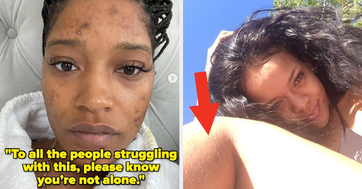 15 Times Black Celebs Posted Unfiltered And Unretouched Photos Online 15 Times Black Celebs Posted Unfiltered And Unretouched Photos Online