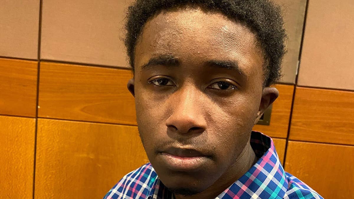 The lawyer shared photos of the injuries she says her client suffered during the alleged assault. Next up, a formal complaint is expected to be filed.