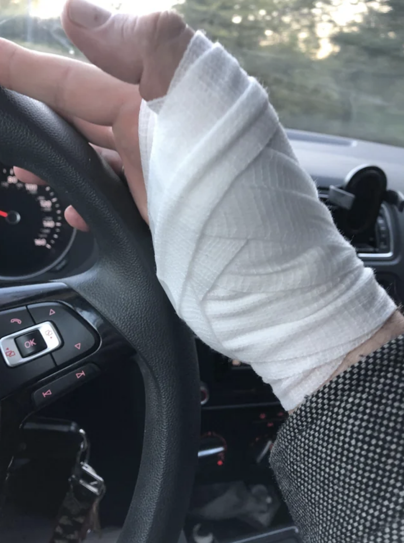 A wrapped hand holding a car wheel