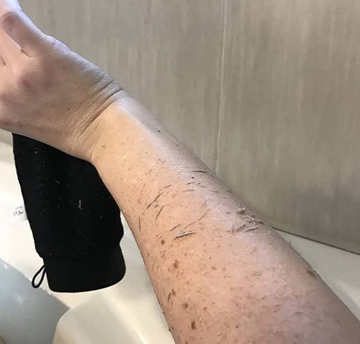 a reviewer photo of someone&#x27;s arm after using the mitt