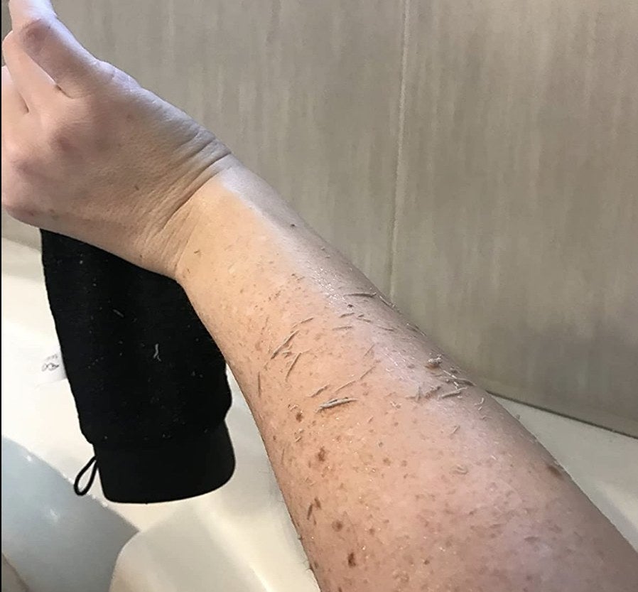 a reviewer photo of someone&#x27;s arm after using the mitt
