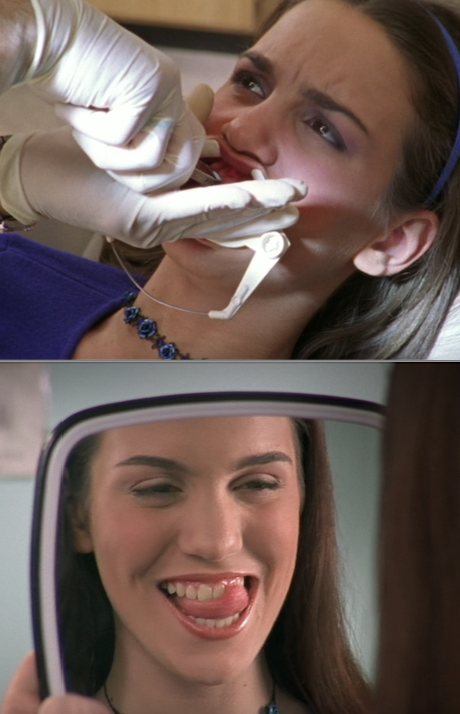 Ren getting her braces off in &quot;Even Stevens&quot;