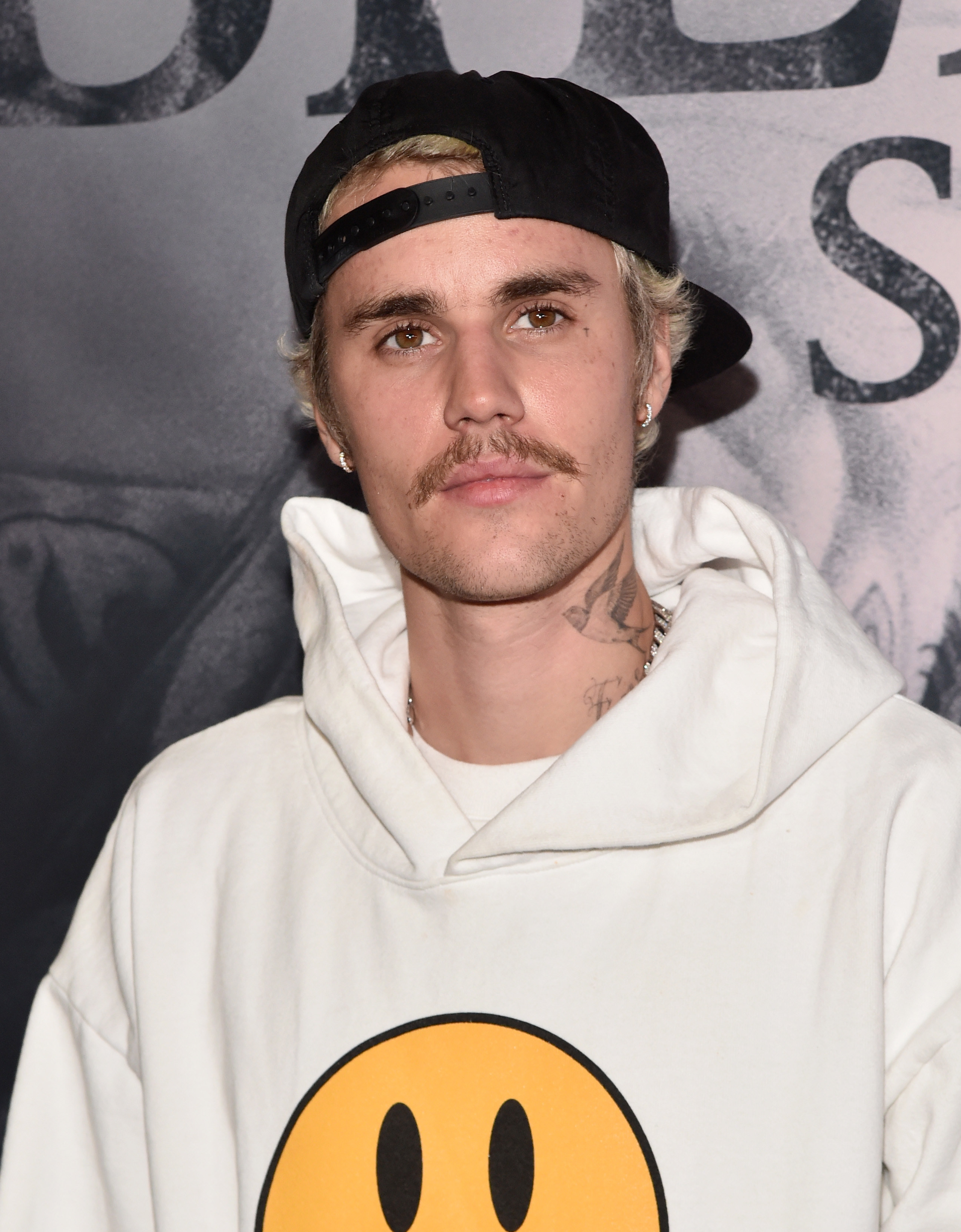 Justin Bieber Regains Mobility In His Face After Paralysis